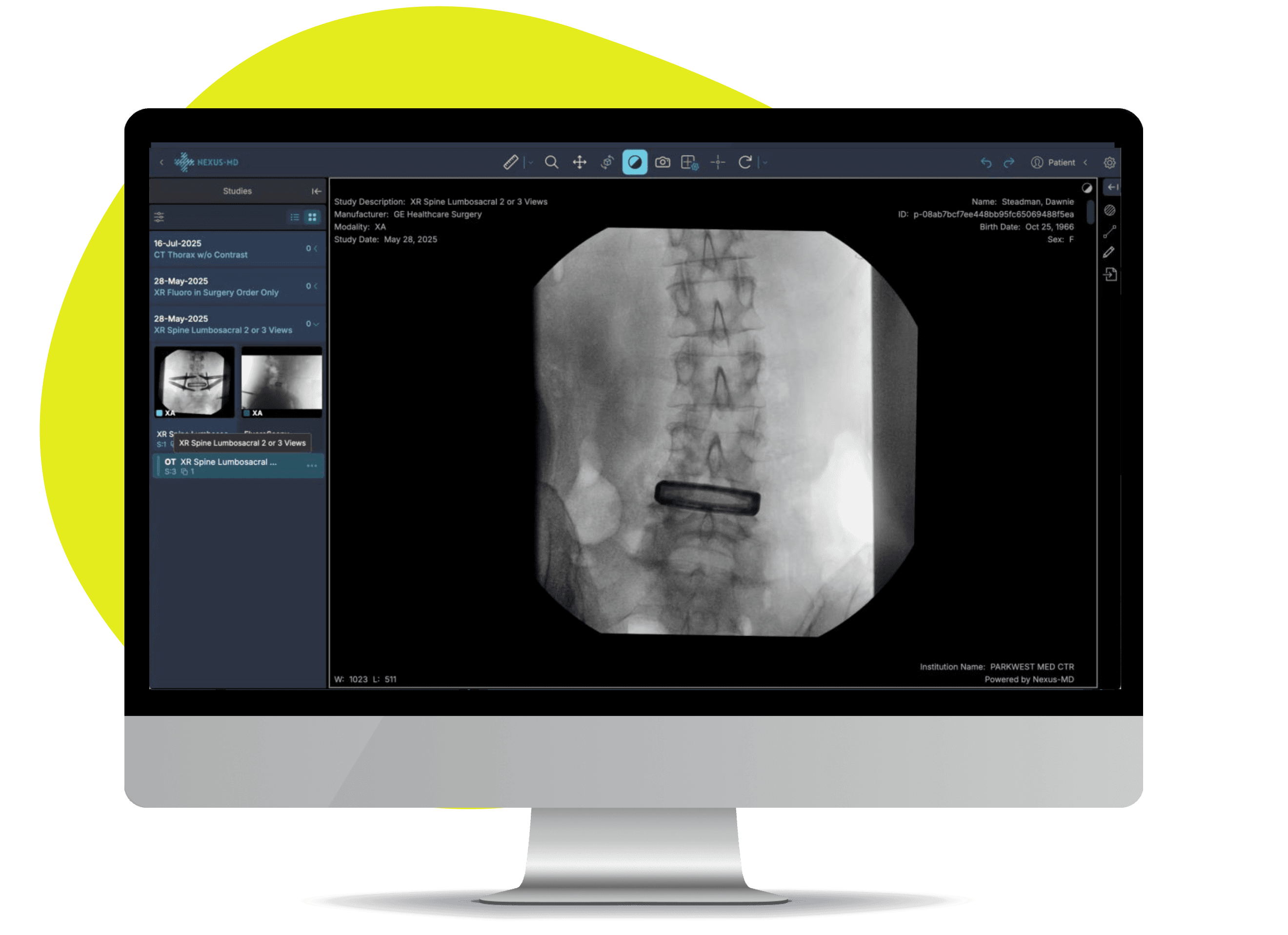 NEXUS-MD DICOM viewer interface on desktop monitor showing spine X-ray imaging with study information and patient data