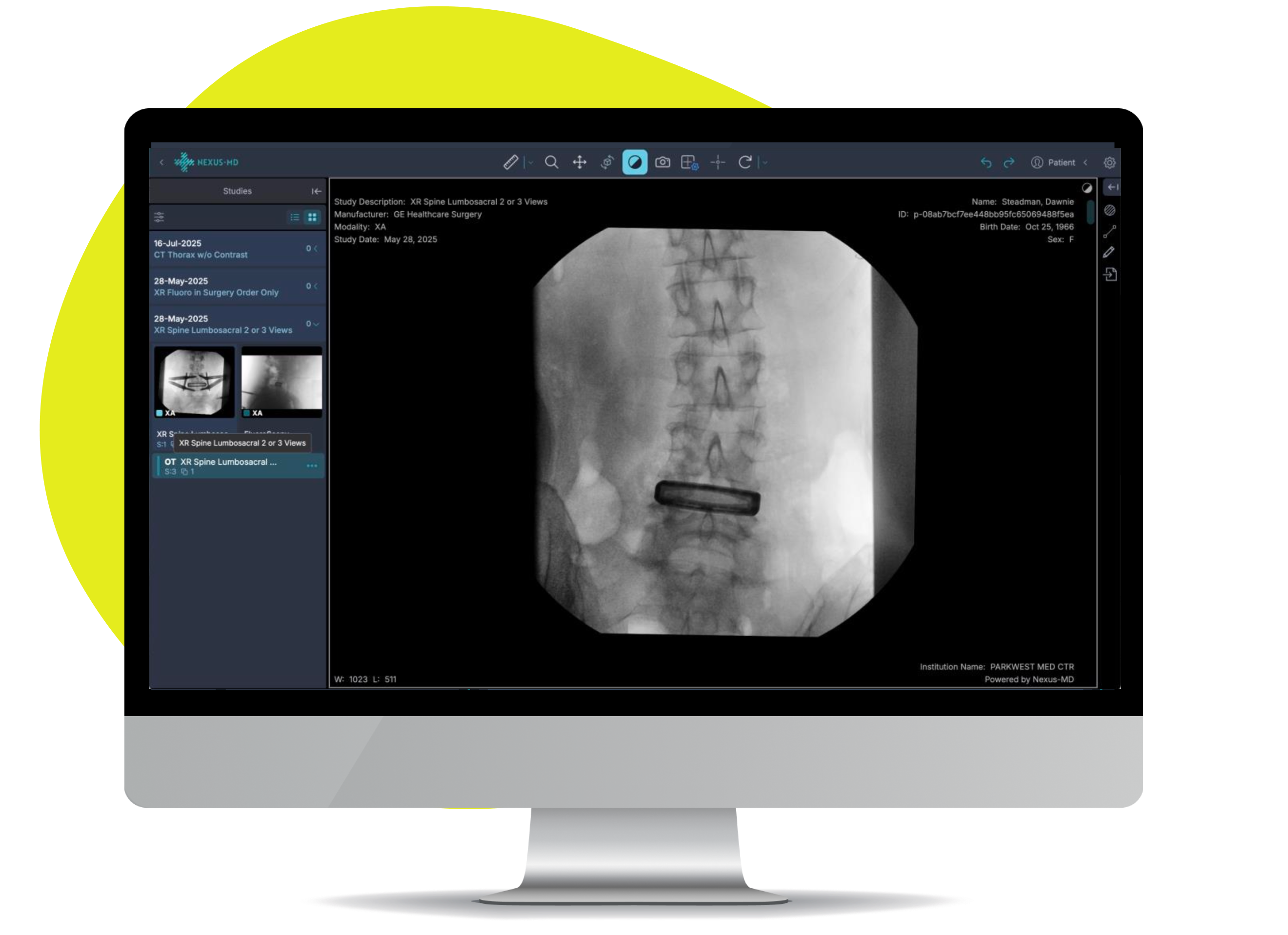 NEXUS-MD DICOM viewer interface on desktop monitor showing spine X-ray imaging with study information and patient data
