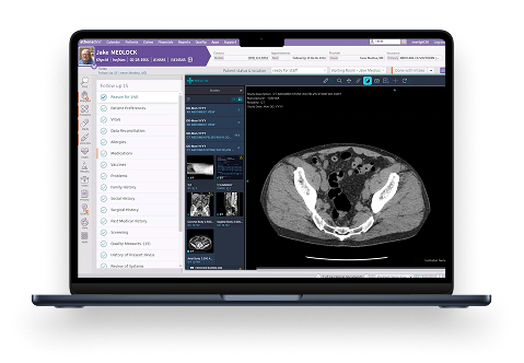 Laptop showing DICOM viewer with medical imaging inside athenaOne interface